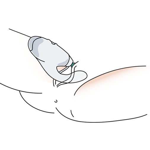 2. Inserta suavemente el estimulador en la vagina y rodea el clítoris con el cabezal de estimulación.